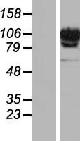 DIS3L Protein - Western validation with an anti-DDK antibody * L: Control HEK293 lysate R: Over-expression lysate