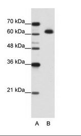 DIS3L2 Antibody - B: Jurkat Cell Lysate.  This image was taken for the unconjugated form of this product. Other forms have not been tested.