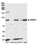 DIS3L2 Antibody - Detection of human DIS3L2 by western blot. Samples: Whole cell lysate (50 µg) from HEK293T, U2OS, Hep-G2, MCF-7, and GaMG cells prepared using NETN lysis buffer. Antibody: Affinity purified Rabbit anti-DIS3L2 antibody used for WB at 1:1000. Detection: Chemiluminescence with an exposure time of 3 minutes.