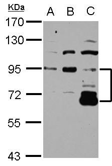 DIS3L2 Antibody - Sample (30 ug of whole cell lysate) A: NT2D1 B: IMR32 C: U87-MG 7.5% SDS PAGE DIS3L2 antibody diluted at 1:3000
