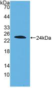 DISC1 Antibody - Western Blot; Sample: Recombinant DISC1, Human.