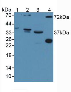 DISC1 Antibody - Western Blot; Sample: Lane1: Human Serum; Lane2: Mouse Brain Tissue; Lane3: Mouse Kidney Tissue; Lane4: Rat Serum.