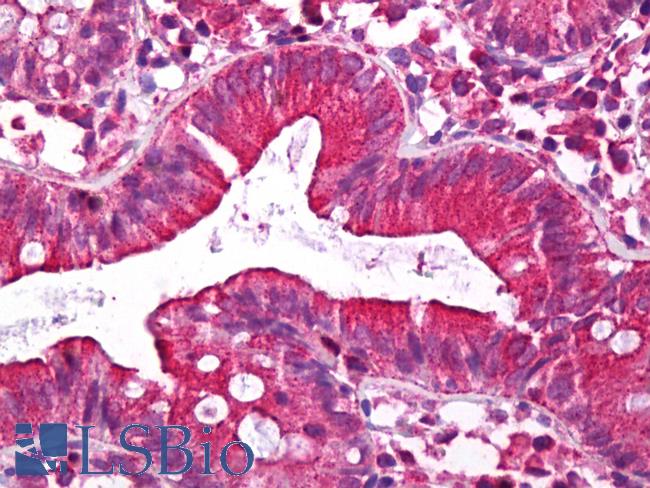 DISC1 Antibody - Anti-DISC1 antibody IHC of human colon, epithelium. Immunohistochemistry of formalin-fixed, paraffin-embedded tissue after heat-induced antigen retrieval. Antibody concentration 5 ug/ml.  This image was taken for the unconjugated form of this product. Other forms have not been tested.