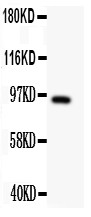 DISC1 Antibody - DISC1 antibody Western blot. All lanes: Anti DISC1 at 0.5 ug/ml. WB: U87 Whole Cell Lysate at 40 ug. Predicted band size: 94 kD. Observed band size: 94 kD.