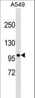 DISC1 Antibody - DISC1 Antibody (Ascites)western blot of A549 cell line lysates (35 ug/lane). The DISC1 antibody detected the DISC1 protein (arrow).