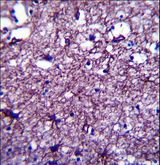 DISC1 Antibody - DISC1 Antibody immunohistochemistry of formalin-fixed and paraffin-embedded human brain tissue followed by peroxidase-conjugated secondary antibody and DAB staining.
