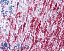 DISC1 Antibody - Anti-DISC1 antibody IHC of human brain, cerebellum, white matter. Immunohistochemistry of formalin-fixed, paraffin-embedded tissue after heat-induced antigen retrieval. Antibody concentration 5 ug/ml.  This image was taken for the unconjugated form of this product. Other forms have not been tested.