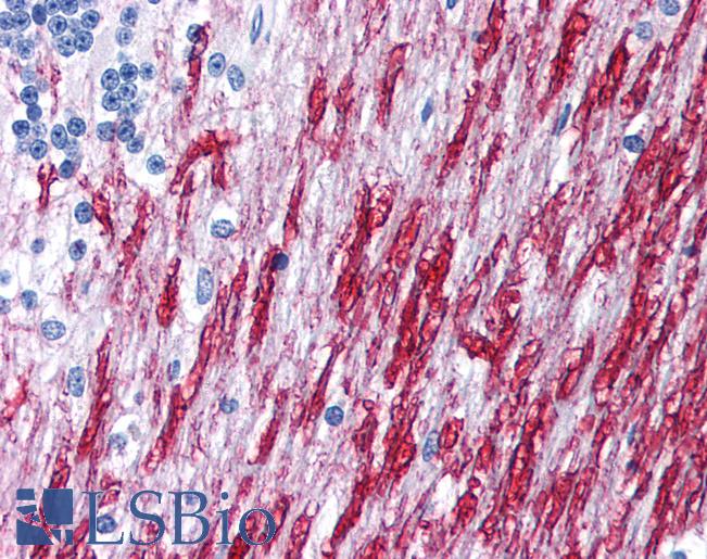 DISC1 Antibody - Anti-DISC1 antibody IHC of human brain, cerebellum, white matter. Immunohistochemistry of formalin-fixed, paraffin-embedded tissue after heat-induced antigen retrieval. Antibody concentration 5 ug/ml.  This image was taken for the unconjugated form of this product. Other forms have not been tested.