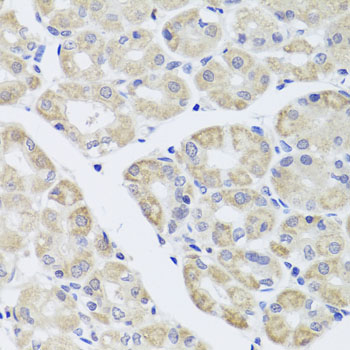 DISC1 Antibody - Immunohistochemistry of paraffin-embedded human stomach tissue.
