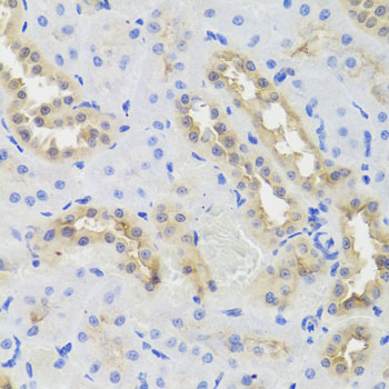 DISC1 Antibody - Immunohistochemistry of paraffin-embedded rat kidney tissue.