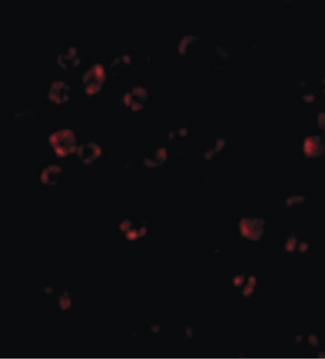 DISC1 Antibody - Immunofluorescence of DISC1 in HeLa cells with DISC1 antibody at 20 ug/ml.