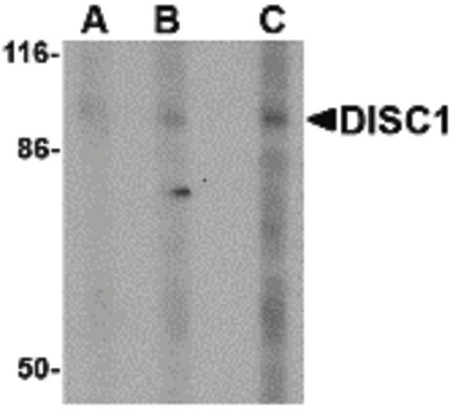 DISC1 Antibody - Western blot of DISC1 in SK-N-SH cell lysate with DISC1 antibody at (A) 0.5, (B) 1 and (C) 2 ug/ml.