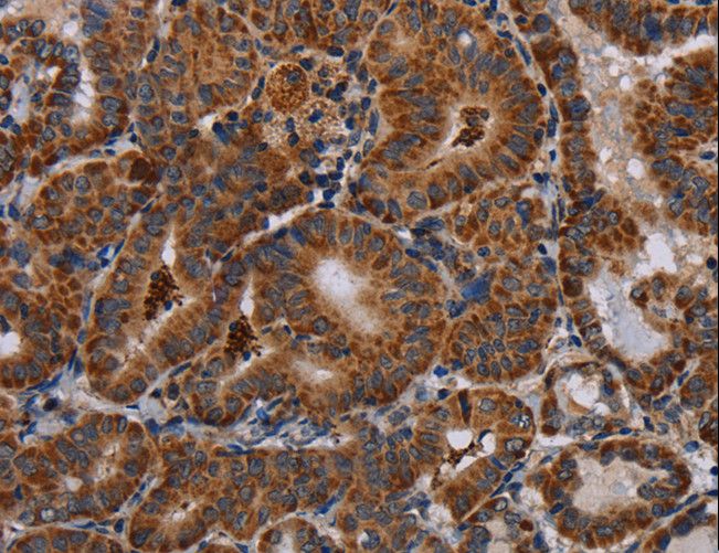 DISC1 Antibody - Immunohistochemistry of paraffin-embedded Human brain using DISC1 Polyclonal Antibody at dilution of 1:30.