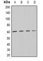 DISC1 Antibody - Western blot analysis of DISC-1 expression in HL60 (A); SW620 (B); mouse heart (C); rat brain (D) whole cell lysates.