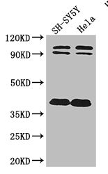 DISC1 Antibody - Positive WB detected in:SH-SY5Y whole cell lysate,Hela whole cell lysate;All lanes: DISC1 antibody at 2ug/ml;Secondary;Goat polyclonal to rabbit IgG at 1/50000 dilution;Predicted band size: 94,92,74,39,83,63,61,76,73,38,22 kDa;Observed band size: 94,92,38 kDa;