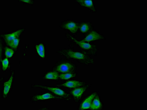 DISC1 Antibody - Immunofluorescent analysis of Hela cells using DISC1 Antibody at a dilution of 1:100 and Alexa Fluor 488-congugated AffiniPure Goat Anti-Rabbit IgG(H+L)