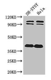 DISC1 Antibody - Western Blot Positive WB detected in: SH-SY5Y whole cell lysate, Hela whole cell lysate All lanes: DISC1 antibody at 2µg/ml Secondary Goat polyclonal to rabbit IgG at 1/50000 dilution Predicted band size: 94, 92, 74, 39, 83, 63, 61, 76, 73, 38, 22 kDa Observed band size: 94, 92, 38 kDa