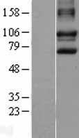DISC1 Protein - Western validation with an anti-DDK antibody * L: Control HEK293 lysate R: Over-expression lysate