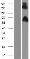 DISC1 Protein - Western validation with an anti-DDK antibody * L: Control HEK293 lysate R: Over-expression lysate
