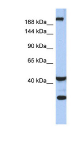 DISPA / DISP1 Antibody - DISP1 / DISPA antibody Western blot of Fetal Small Intestine lysate. This image was taken for the unconjugated form of this product. Other forms have not been tested.