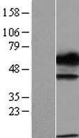 Disulfide Isomerase / TXNDC15 Protein - Western validation with an anti-DDK antibody * L: Control HEK293 lysate R: Over-expression lysate