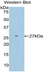 DIXDC1 Antibody - Western blot of recombinant DIXDC1.  This image was taken for the unconjugated form of this product. Other forms have not been tested.