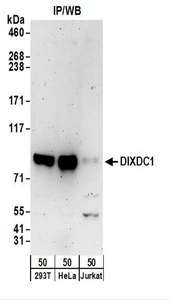 DIXDC1 Antibody - Detection of Human DIXDC1 by Western Blot. Samples: Whole cell lysate (50 ug) from 293T, HeLa, and Jurkat cells. Antibodies: Affinity purified rabbit anti-DIXDC1 antibody used for WB at 0.4 ug/ml. Detection: Chemiluminescence with an exposure time of 3 minutes.