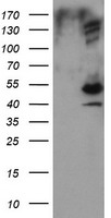 DIXDC1 Antibody - HEK293T cells were transfected with the pCMV6-ENTRY control (Left lane) or pCMV6-ENTRY DIXDC1 (Right lane) cDNA for 48 hrs and lysed. Equivalent amounts of cell lysates (5 ug per lane) were separated by SDS-PAGE and immunoblotted with anti-DIXDC1.