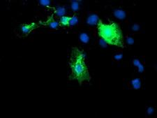 DIXDC1 Antibody - Anti-DIXDC1 mouse monoclonal antibody immunofluorescent staining of COS7 cells transiently transfected by pCMV6-ENTRY DIXDC1.