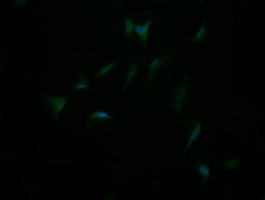 DIXDC1 Antibody - Immunofluorescent staining of HeLa cells using anti-DIXDC1 mouse monoclonal antibody.