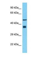 DIXDC1 Antibody - Western blot of DIXDC1 Antibody with human 786-0 Whole Cell lysate.  This image was taken for the unconjugated form of this product. Other forms have not been tested.