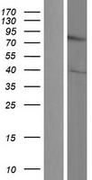 DIXDC1 Protein - Western validation with an anti-DDK antibody * L: Control HEK293 lysate R: Over-expression lysate