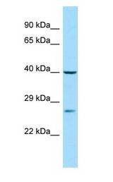 DJ858B16.2 / PISD Antibody - DJ858B16.2 / PISD antibody Western Blot of 721_B.  This image was taken for the unconjugated form of this product. Other forms have not been tested.