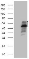 DJ858B16.2 / PISD Antibody - HEK293T cells were transfected with the pCMV6-ENTRY control (Left lane) or pCMV6-ENTRY PISD (Right lane) cDNA for 48 hrs and lysed. Equivalent amounts of cell lysates (5 ug per lane) were separated by SDS-PAGE and immunoblotted with anti-PISD.