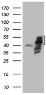 DJ858B16.2 / PISD Antibody - HEK293T cells were transfected with the pCMV6-ENTRY control. (Left lane) or pCMV6-ENTRY PISD. (Right lane) cDNA for 48 hrs and lysed. Equivalent amounts of cell lysates. (5 ug per lane) were separated by SDS-PAGE and immunoblotted with anti-PISD.