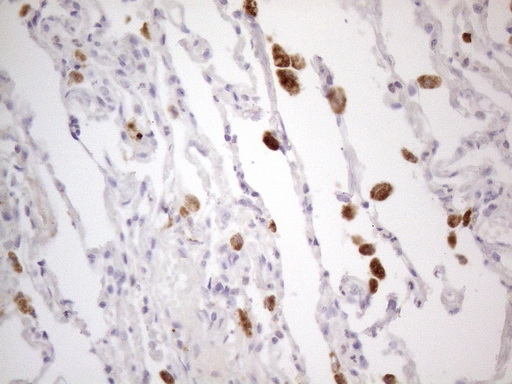 DJ858B16.2 / PISD Antibody - Immunohistochemical staining of paraffin-embedded Human lung tissue within the normal limits using anti-PISD mouse monoclonal antibody. (Heat-induced epitope retrieval by 1mM EDTA in 10mM Tris buffer. (pH8.5) at 120°C for 3 min. (1:150)