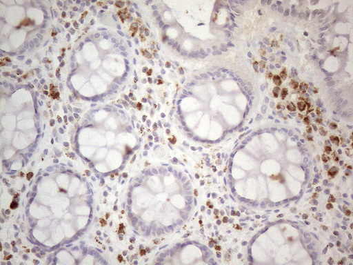 DJ858B16.2 / PISD Antibody - Immunohistochemical staining of paraffin-embedded Human colon tissue within the normal limits using anti-PISD mouse monoclonal antibody. (Heat-induced epitope retrieval by 1mM EDTA in 10mM Tris buffer. (pH8.5) at 120°C for 3 min. (1:150)