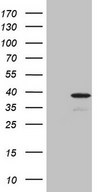 DJ858B16.2 / PISD Antibody - HEK293T cells were transfected with the pCMV6-ENTRY control (Left lane) or pCMV6-ENTRY PISD (Right lane) cDNA for 48 hrs and lysed. Equivalent amounts of cell lysates (5 ug per lane) were separated by SDS-PAGE and immunoblotted with anti-PISD (1:2000).