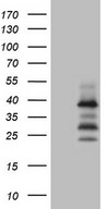 DJ858B16.2 / PISD Antibody - HEK293T cells were transfected with the pCMV6-ENTRY control. (Left lane) or pCMV6-ENTRY PISD. (Right lane) cDNA for 48 hrs and lysed. Equivalent amounts of cell lysates. (5 ug per lane) were separated by SDS-PAGE and immunoblotted with anti-PISD. (1:2000)