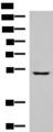 DJ858B16.2 / PISD Antibody - Western blot analysis of Human fetal liver tissue lysate  using PISD Polyclonal Antibody at dilution of 1:600