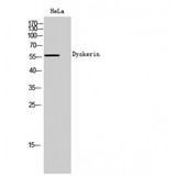 DKC1 / Dyskerin Antibody - Western blot of Dyskerin antibody