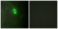 DKC1 / Dyskerin Antibody - Immunofluorescence analysis of HeLa cells, using Dyskerin Antibody. The picture on the right is blocked with the synthesized peptide.