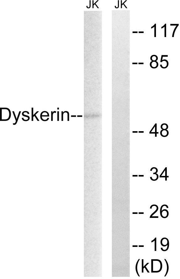 DKC1 / Dyskerin Antibody - Western blot analysis of lysates from JurKat cells, using Dyskerin Antibody. The lane on the right is blocked with the synthesized peptide.