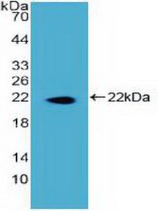 DKC1 / Dyskerin Antibody - Western Blot; Sample: Recombinant DKC, Human.