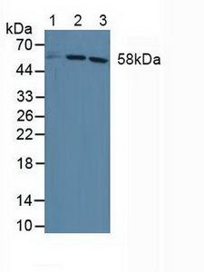 DKC1 / Dyskerin Antibody - Western Blot; Sample: Lane1: Human HepG2 Cells; Lane2: Human Jurkat Cells; Lane3: Human Hela Cells.