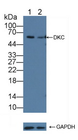 DKC1 / Dyskerin Antibody - Knockout Varification: Lane 1: Wild-type HepG2 cell lysate; Lane 2: DKC knockout HepG2 cell lysate; Predicted MW: 58,48kd Observed MW: 58kd Primary Ab: 1µg/ml Rabbit Anti-Human DKC Antibody Second Ab: 0.2µg/mL HRP-Linked Caprine Anti-Rabbit IgG Polyclonal Antibody