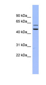 DKC1 / Dyskerin Antibody - DKC1 antibody Western blot of Fetal Small Intestine lysate. This image was taken for the unconjugated form of this product. Other forms have not been tested.