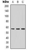 DKC1 / Dyskerin Antibody - Western blot analysis of Dyskerin expression in MCF7 (A); HepG2 (B); Jurkat (C) whole cell lysates.