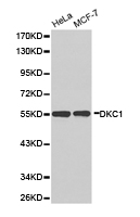 DKC1 / Dyskerin Antibody - Western blot of extracts of various cell lines, using DKC1 antibody.