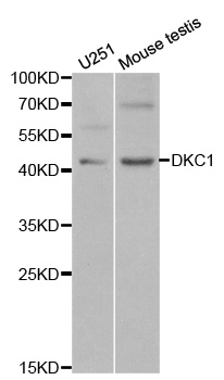 DKC1 / Dyskerin Antibody - Western blot analysis of extracts of various cell lines.